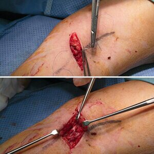 Medical Fotography