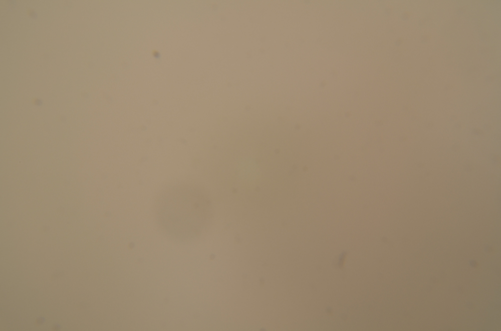 20120117 0002 Sensorreinigung