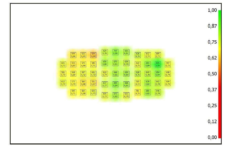 70 200@ 70 2.8