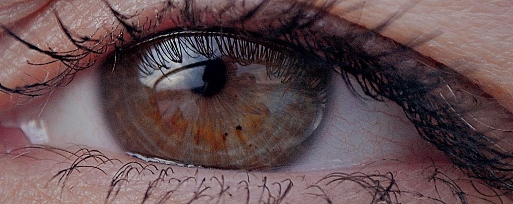 auge