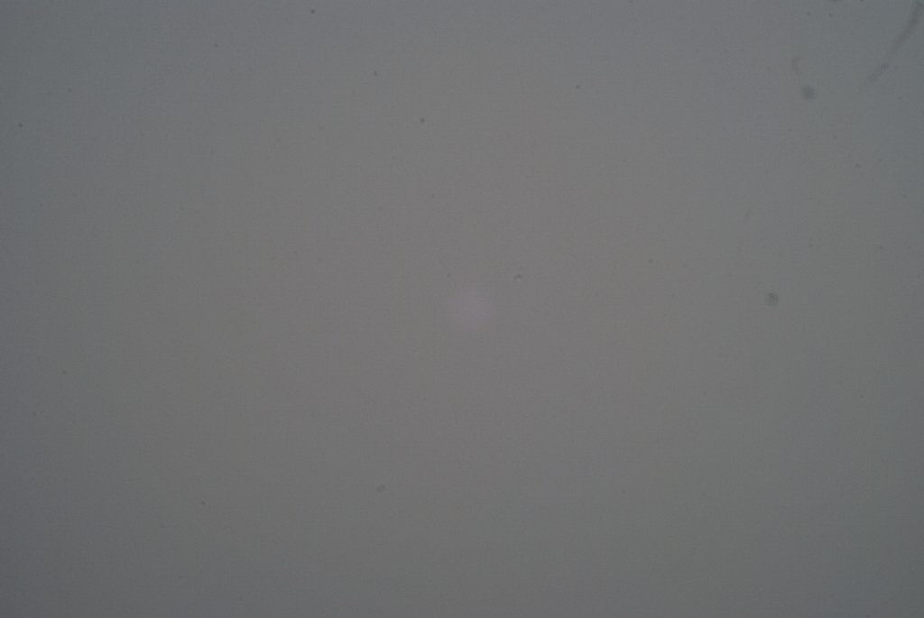 dreckiger sensor resized