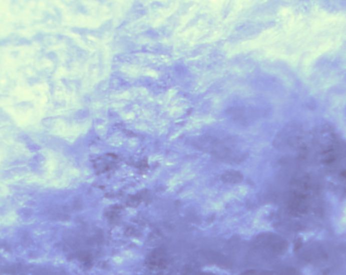 TrockeneKnoblauchschale2