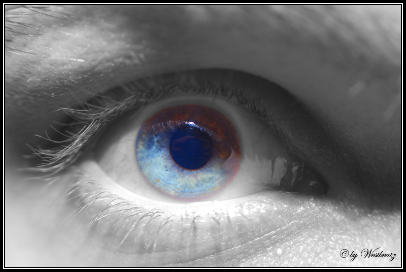 Vik eye